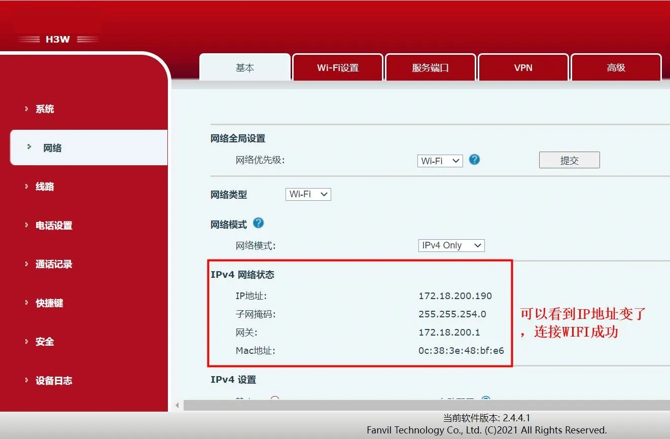 صفحة إعدادات الشبكة في واجهة الويب الخاصة بالهاتف